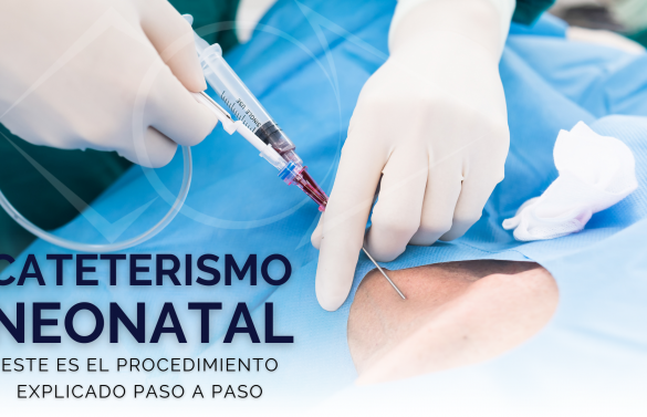 Procedimiento paso a paso del Cateterismo Neonatal
